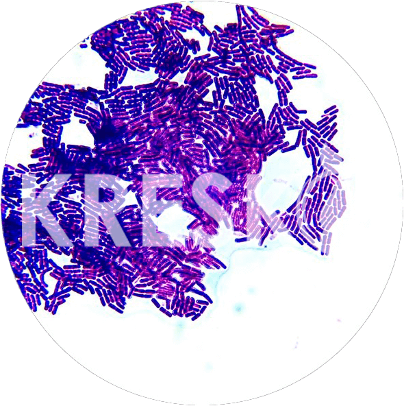Bacillus aryabhattai